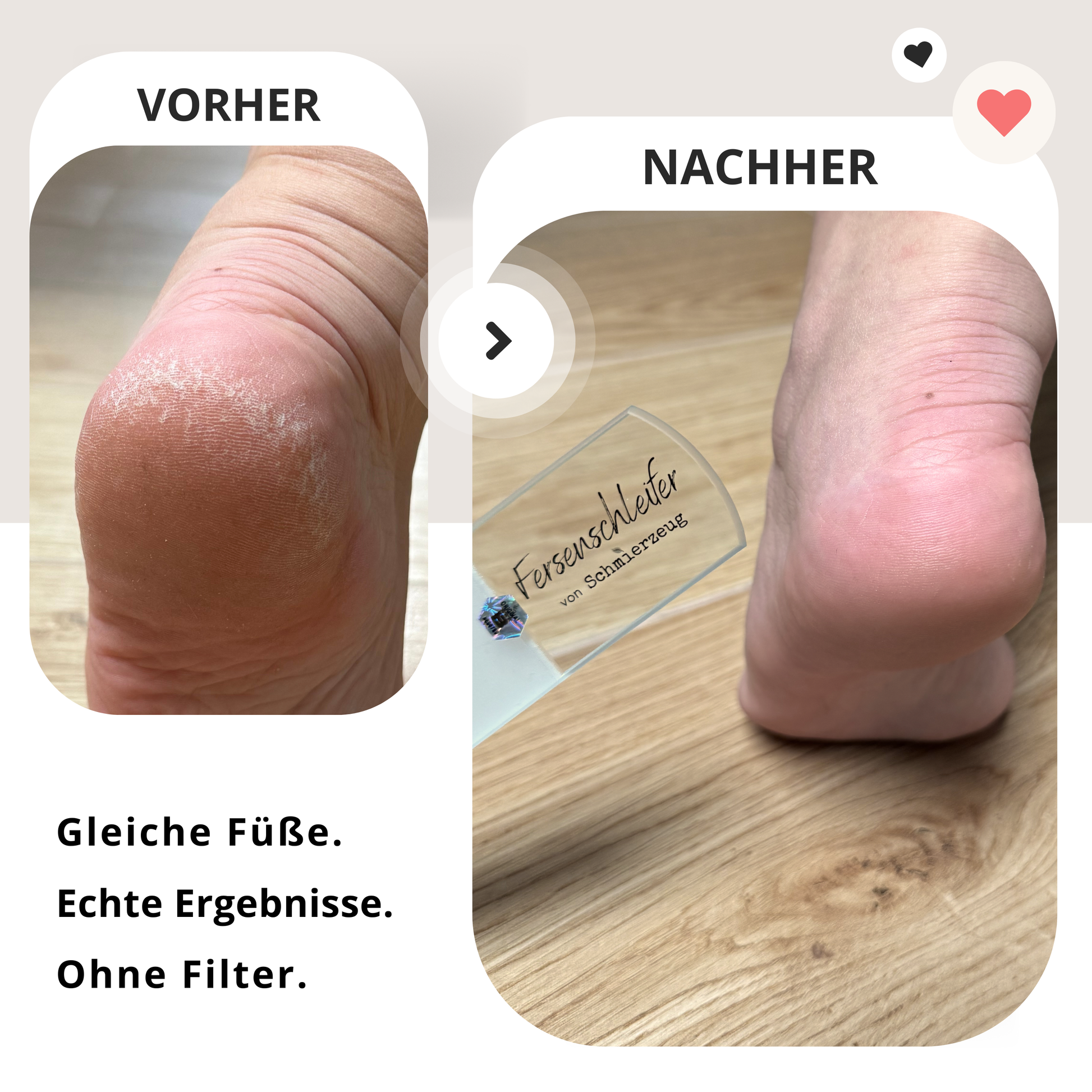 Vorher-Nachher Vergleich mit Hornhautfeile Glas – glatte Füße durch sanfte Hornhautentfernung mit Hornhautfeile aus Glas mit zwei Seiten.